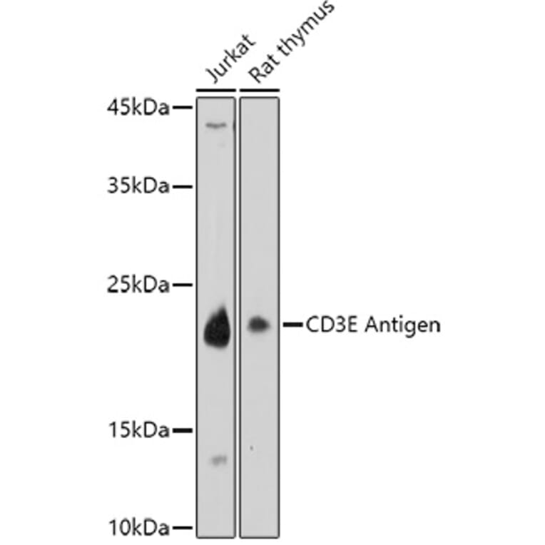 Western Blot - Anti-CD3 epsilon Antibody (A87625) - Antibodies.com