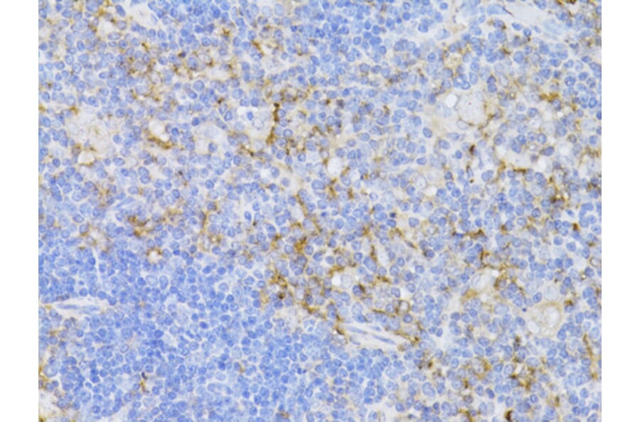 Immunohistochemistry - Anti-CD3 epsilon Antibody (A87625) - Antibodies.com