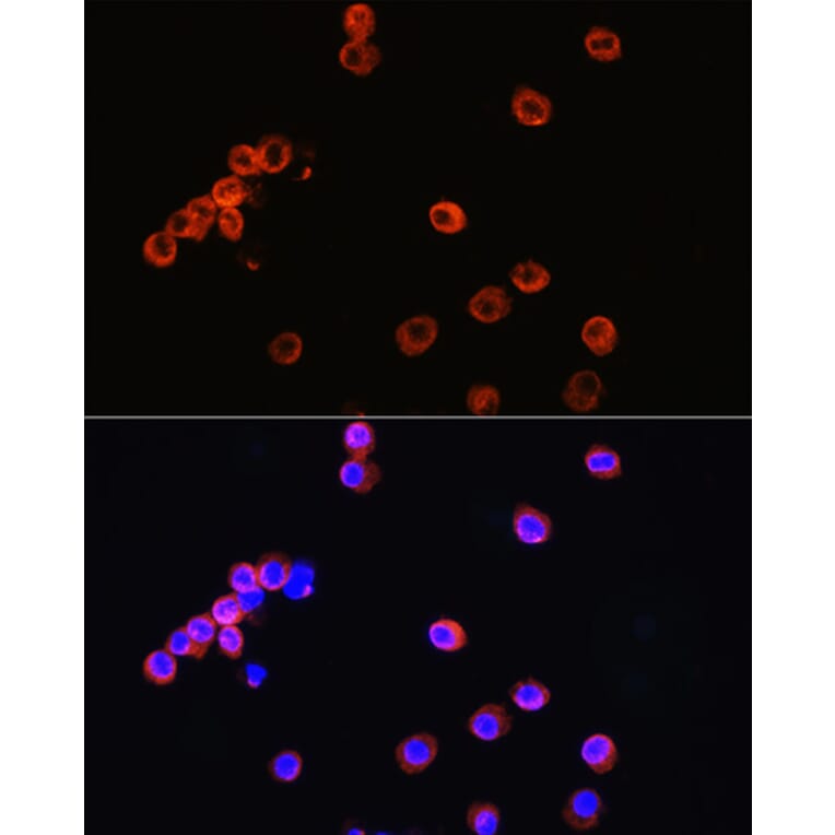 Immunofluorescence - Anti-CD3 epsilon Antibody (A87625) - Antibodies.com
