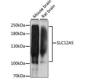 Western Blot - Anti-KCC2 Antibody (A87626) - Antibodies.com