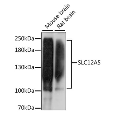 Western Blot - Anti-KCC2 Antibody (A87626) - Antibodies.com