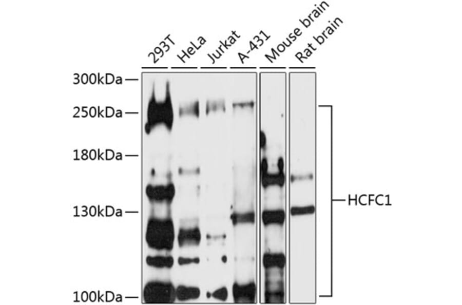 Western Blot - Anti-HCF-1/Host Cell Factor C1 Antibody (A87627) - Antibodies.com