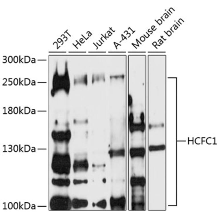 Western Blot - Anti-HCF-1/Host Cell Factor C1 Antibody (A87627) - Antibodies.com
