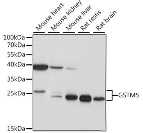 Western Blot - Anti-GSTM5 Antibody (A87628) - Antibodies.com