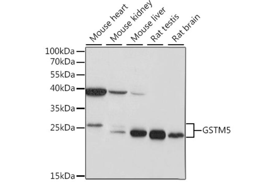 Western Blot - Anti-GSTM5 Antibody (A87628) - Antibodies.com