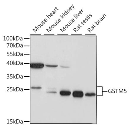 Western Blot - Anti-GSTM5 Antibody (A87628) - Antibodies.com