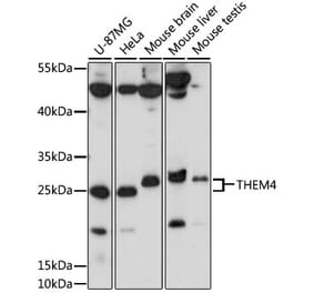 Western Blot - Anti-THEM4 Antibody (A87629) - Antibodies.com