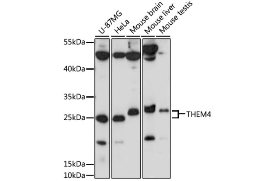 Western Blot - Anti-THEM4 Antibody (A87629) - Antibodies.com