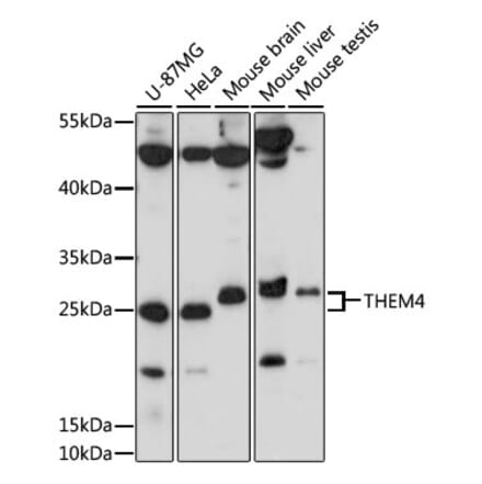 Western Blot - Anti-THEM4 Antibody (A87629) - Antibodies.com