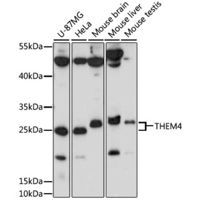 Western Blot - Anti-THEM4 Antibody (A87629) - Antibodies.com