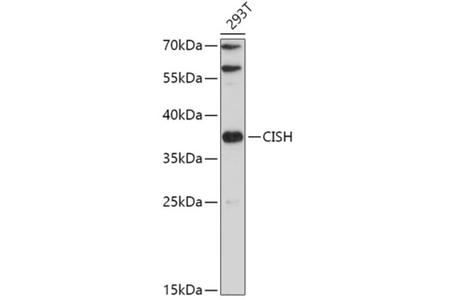 Western Blot - Anti-CISH/CIS Antibody (A87630) - Antibodies.com