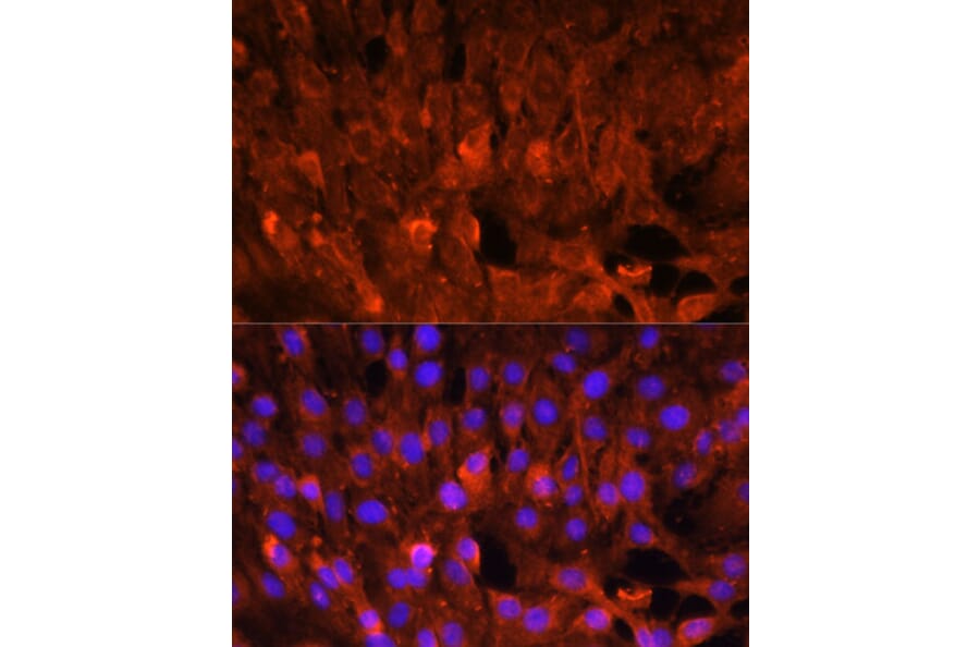 Immunofluorescence - Anti-CISH/CIS Antibody (A87630) - Antibodies.com