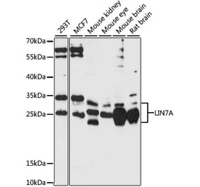 Western Blot - Anti-LIN7A Antibody (A87631) - Antibodies.com
