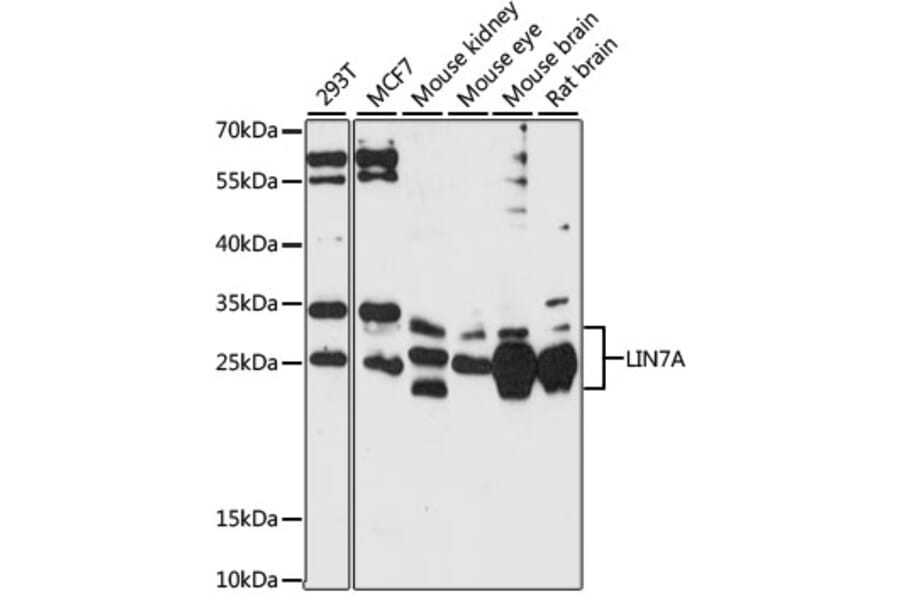 Western Blot - Anti-LIN7A Antibody (A87631) - Antibodies.com