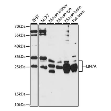 Western Blot - Anti-LIN7A Antibody (A87631) - Antibodies.com