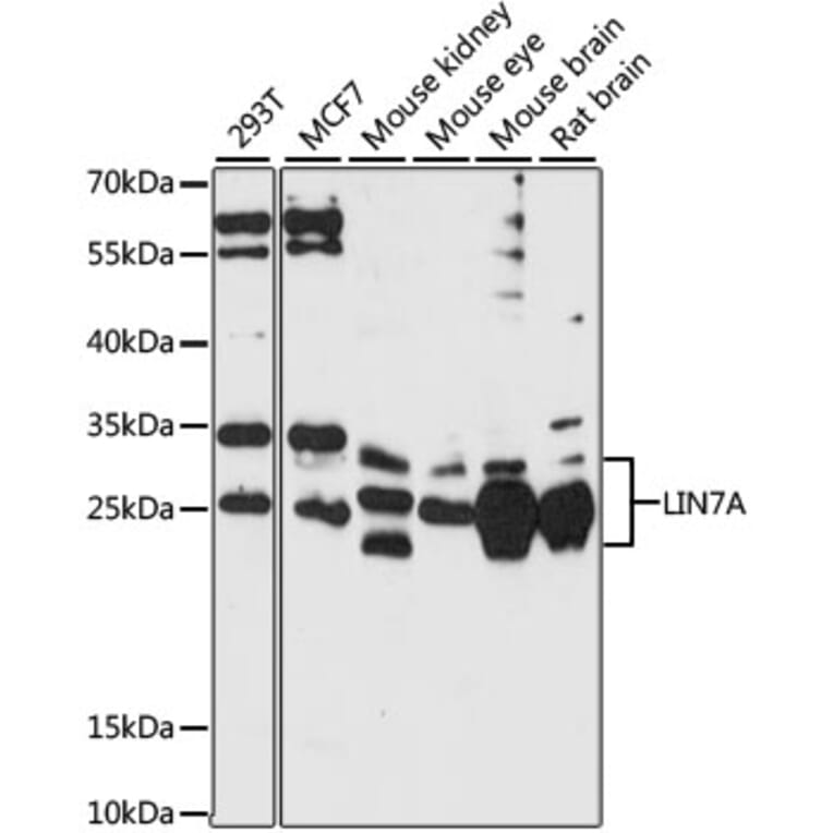 Western Blot - Anti-LIN7A Antibody (A87631) - Antibodies.com