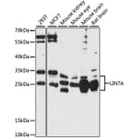 Western Blot - Anti-LIN7A Antibody (A87631) - Antibodies.com