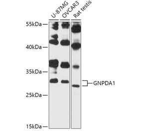 Western Blot - Anti-GNPDA1 Antibody (A87632) - Antibodies.com