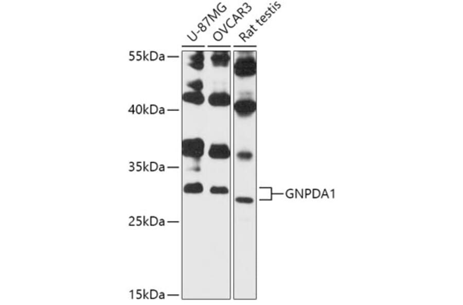 Western Blot - Anti-GNPDA1 Antibody (A87632) - Antibodies.com