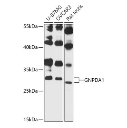 Western Blot - Anti-GNPDA1 Antibody (A87632) - Antibodies.com
