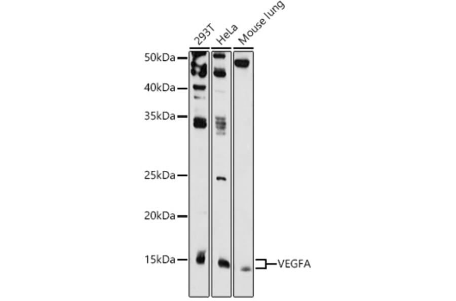 Western Blot - Anti-VEGFA Antibody (A87633) - Antibodies.com