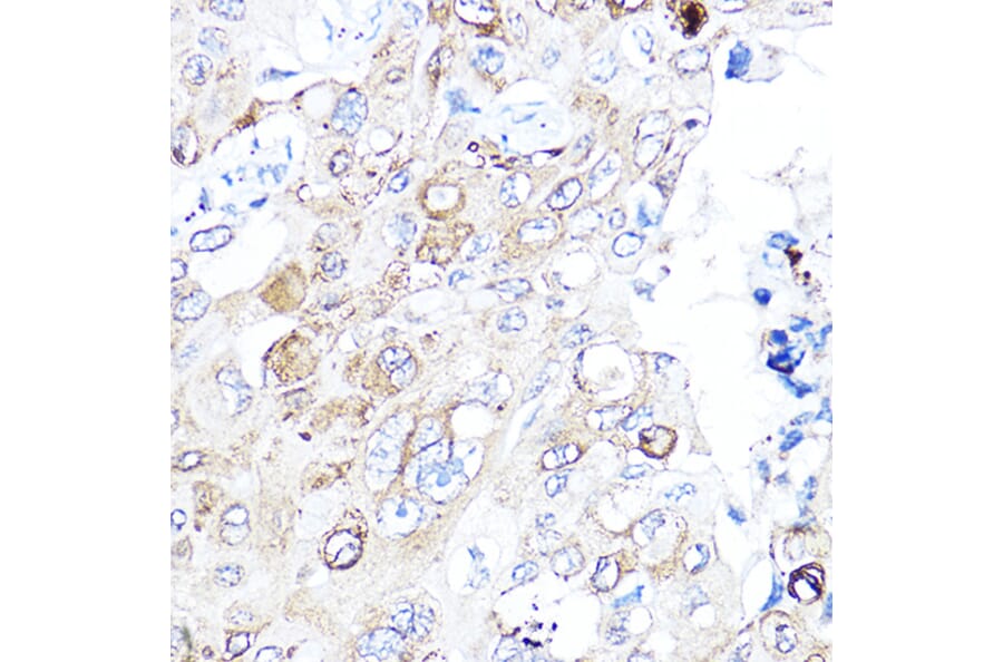 Immunohistochemistry - Anti-VEGFA Antibody (A87633) - Antibodies.com