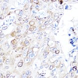 Immunohistochemistry - Anti-VEGFA Antibody (A87633) - Antibodies.com