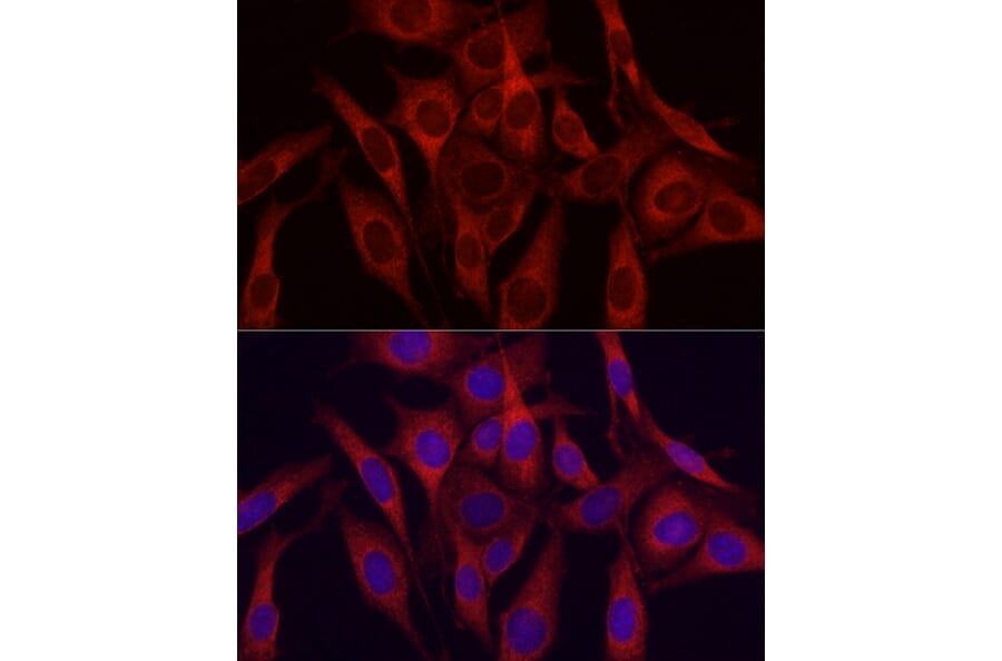 Immunofluorescence - Anti-VEGFA Antibody (A87633) - Antibodies.com