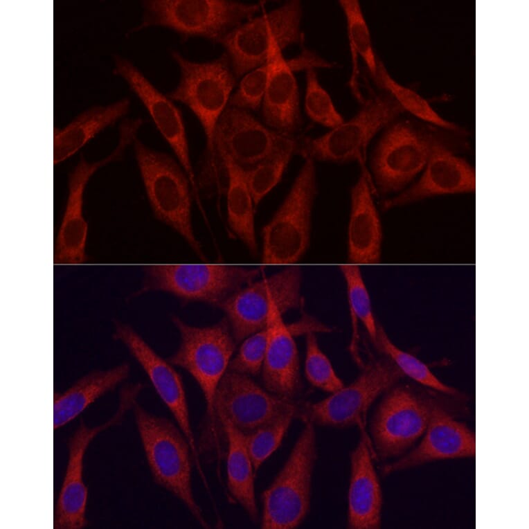 Immunofluorescence - Anti-VEGFA Antibody (A87633) - Antibodies.com