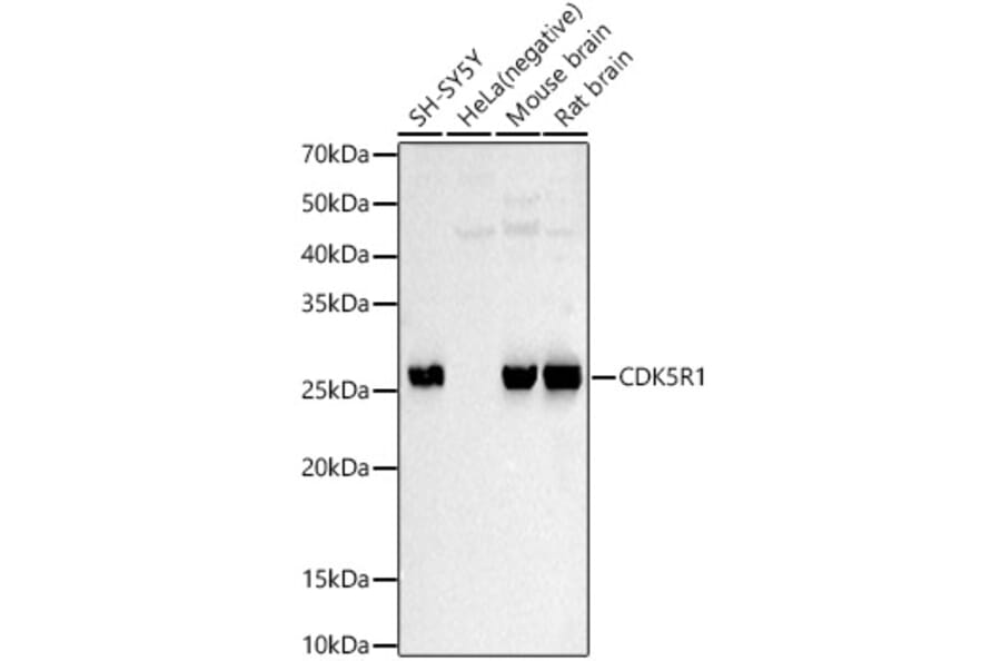 Western Blot - Anti-p35 Antibody (A87634) - Antibodies.com