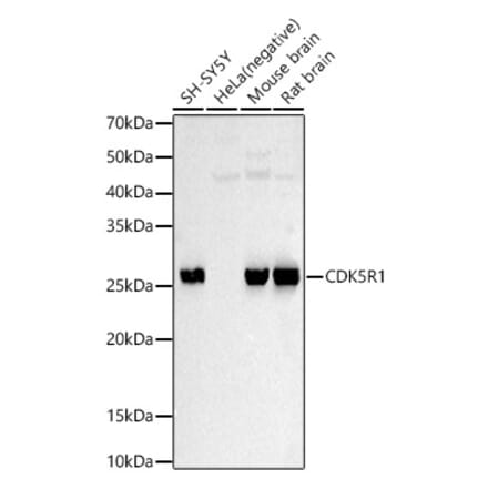 Western Blot - Anti-p35 Antibody (A87634) - Antibodies.com