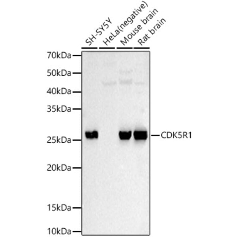 Western Blot - Anti-p35 Antibody (A87634) - Antibodies.com