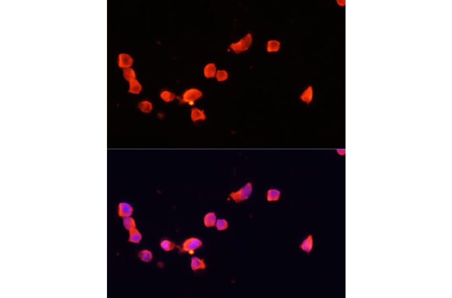 Immunofluorescence - Anti-p35 Antibody (A87634) - Antibodies.com