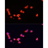 Immunofluorescence - Anti-p35 Antibody (A87634) - Antibodies.com