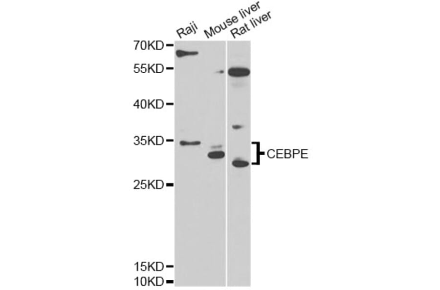 Western Blot - Anti-CEBPE Antibody (A13960) - Antibodies.com