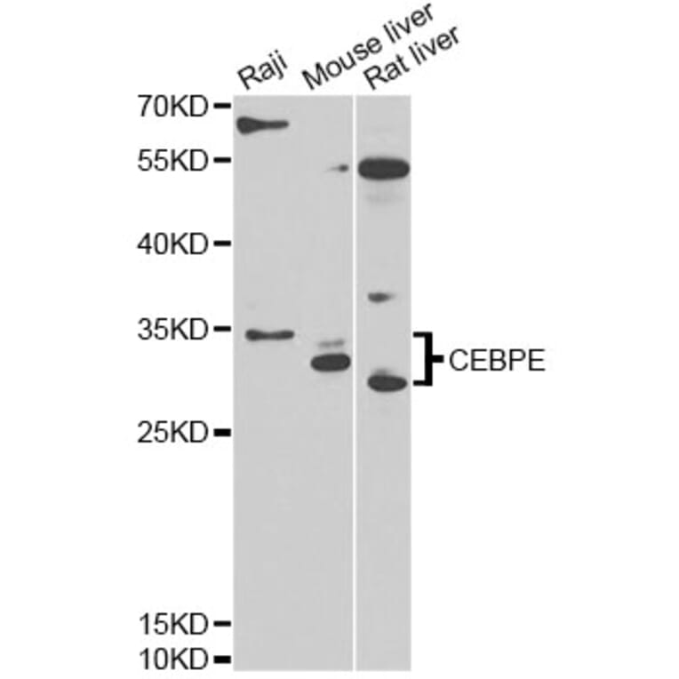 Western Blot - Anti-CEBPE Antibody (A13960) - Antibodies.com