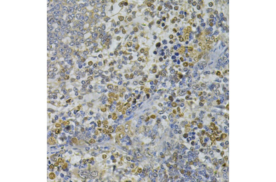 Immunohistochemistry - Anti-CEBPE Antibody (A13960) - Antibodies.com