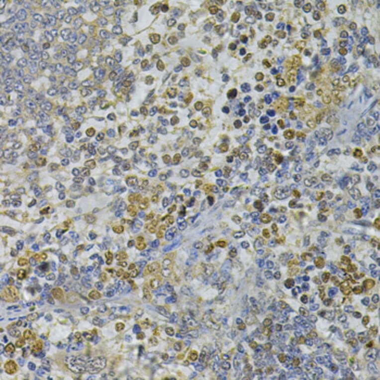Immunohistochemistry - Anti-CEBPE Antibody (A13960) - Antibodies.com