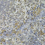 Immunohistochemistry - Anti-CEBPE Antibody (A13960) - Antibodies.com