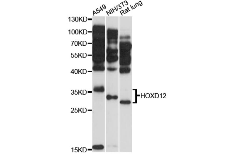 Western Blot - Anti-HOXD12 Antibody (A12870) - Antibodies.com