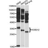 Western Blot - Anti-HOXD12 Antibody (A12870) - Antibodies.com