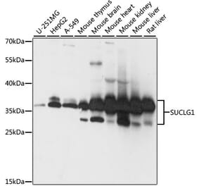 Western Blot - Anti-SUCLG1 Antibody (A87637) - Antibodies.com