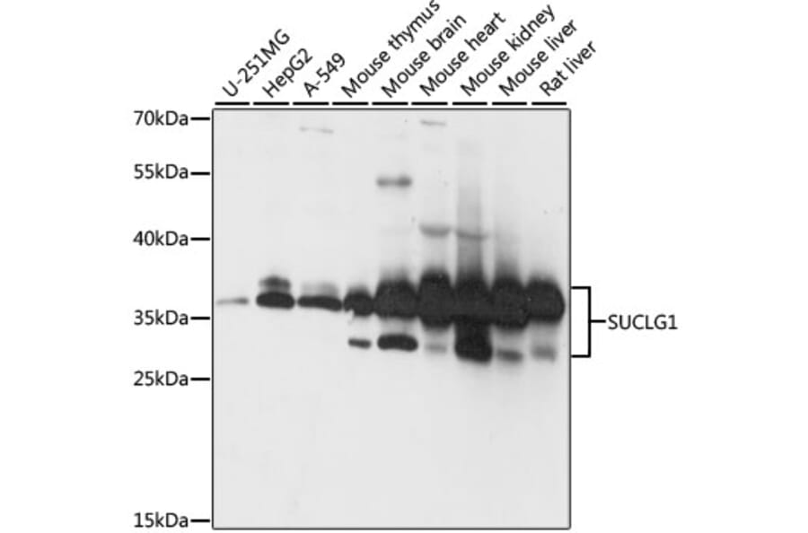 Western Blot - Anti-SUCLG1 Antibody (A87637) - Antibodies.com