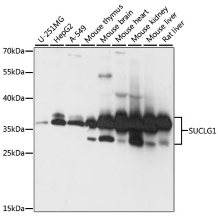 Western Blot - Anti-SUCLG1 Antibody (A87637) - Antibodies.com