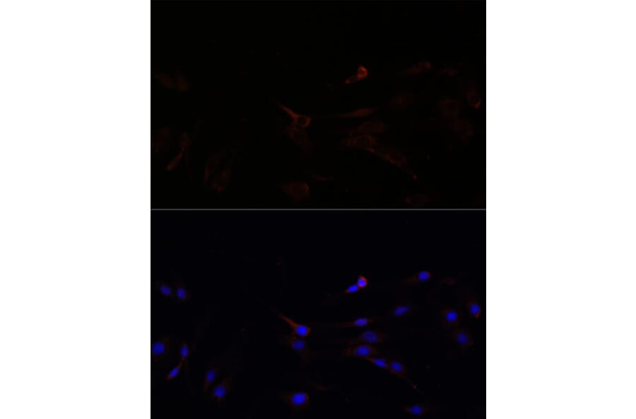 Immunofluorescence - Anti-SUCLG1 Antibody (A87637) - Antibodies.com
