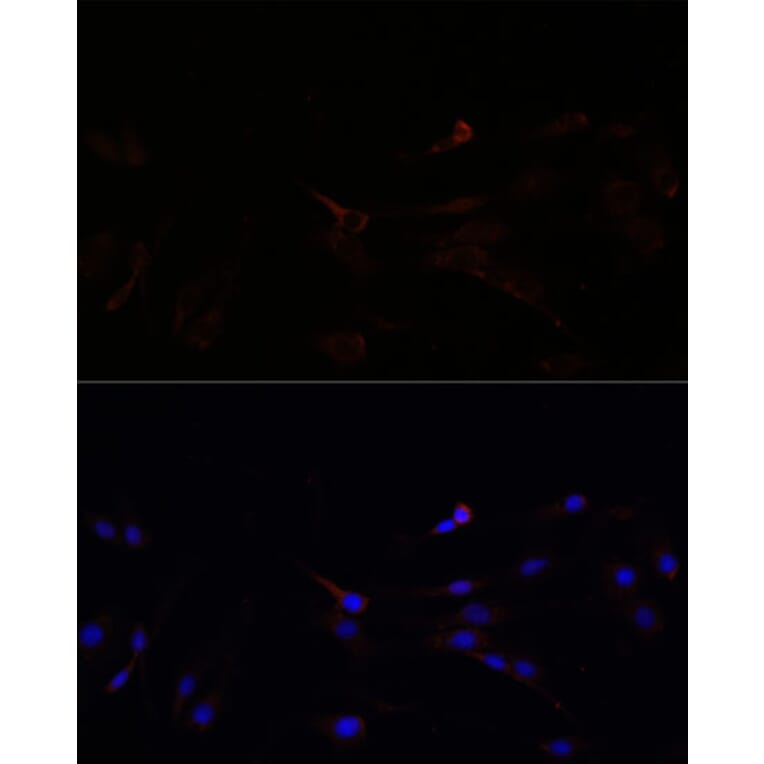 Immunofluorescence - Anti-SUCLG1 Antibody (A87637) - Antibodies.com