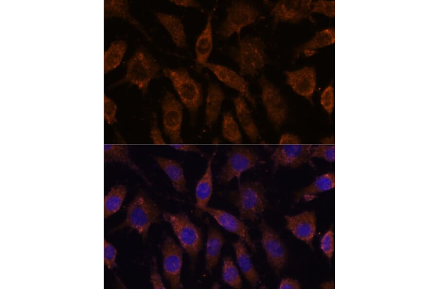 Immunofluorescence - Anti-SUCLG1 Antibody (A87637) - Antibodies.com