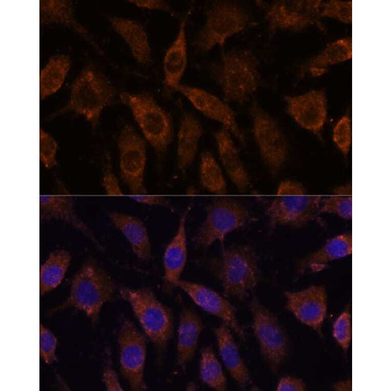 Immunofluorescence - Anti-SUCLG1 Antibody (A87637) - Antibodies.com