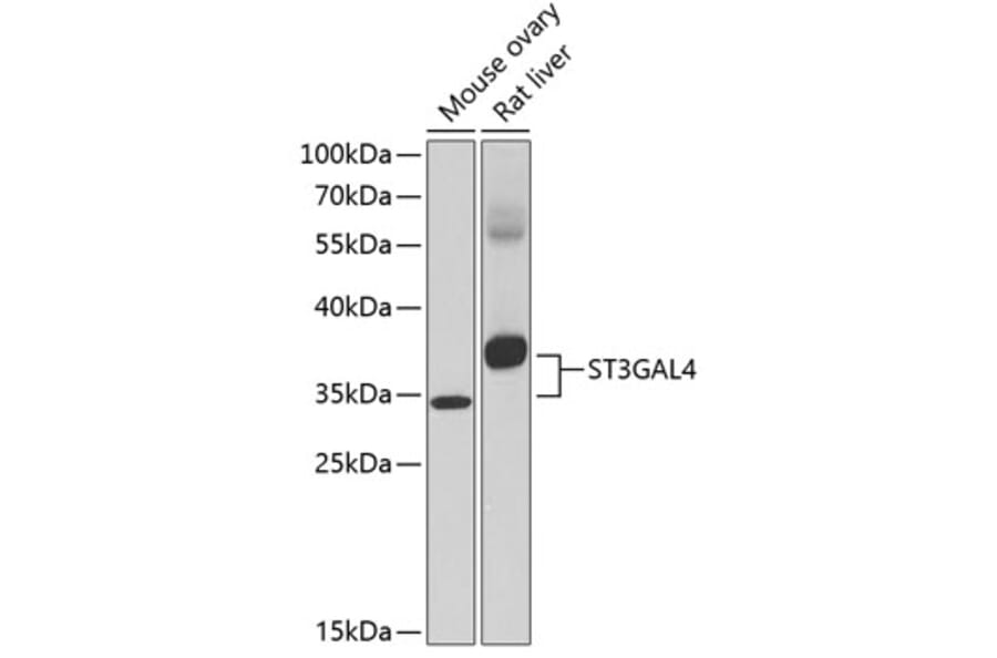 Western Blot - Anti-ST3GAL4 / STZ Antibody (A87638) - Antibodies.com