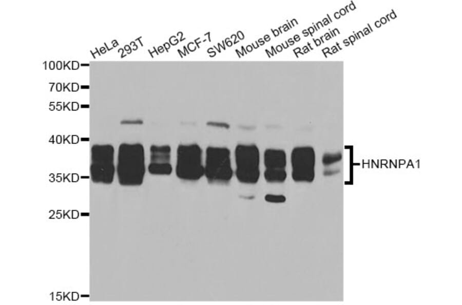 Western Blot - Anti-HNRNPA1 Antibody (A12446) - Antibodies.com
